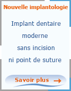 Spcialise dans l'amplantologie dentaire en Tunisie, Implant dentaire Tunisie vous permet de faire des implants dentaires sans incision ni point de suture